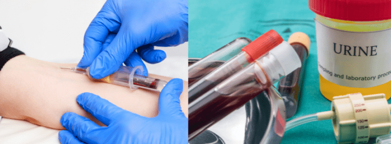 GM1 Gangliosidosis Biobank